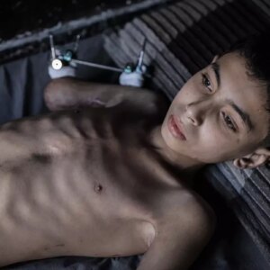 semirin umudu yeniden hayata donmek sYBMT9Cy